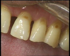 Vorsicht bei zu hohem Langzeitzuckerwert Vorsicht bei zu hohem Langzeitzuckerwert